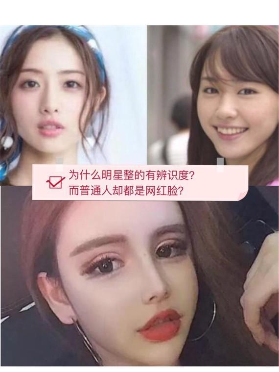 明星网红整形审美分析