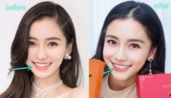明星网红整形审美分析