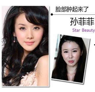 明星网红整形审美分析