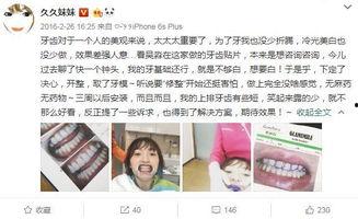 磨牙的明星网红是谁,揭秘磨牙达人背后的故事