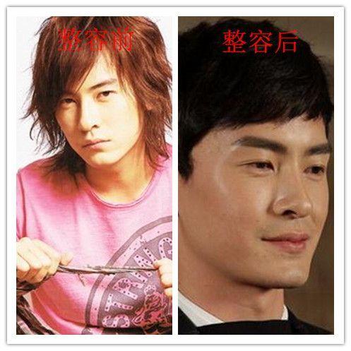 整容失败的男明星网红,男明星网红的惨痛教训